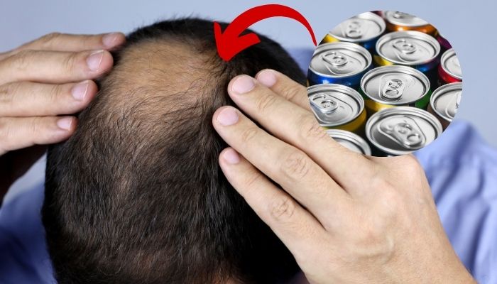 The Hidden Link Between Energy Drinks and Hair Loss: What You Need to Know