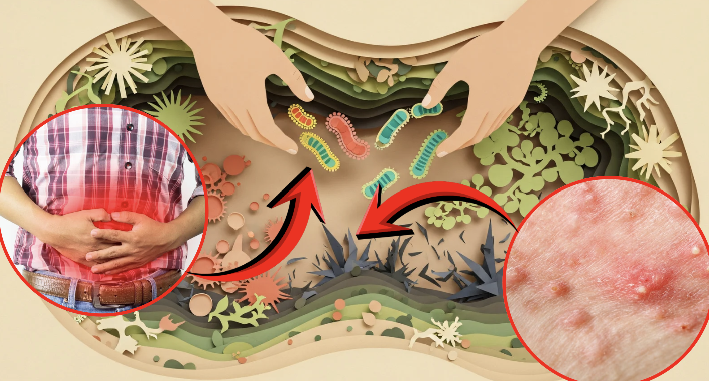 Rebuild Your Gut After the Holidays: A 3-Day Microbiome Reset Plan