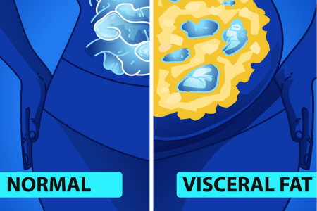 Normal vs. Visceral Fat
