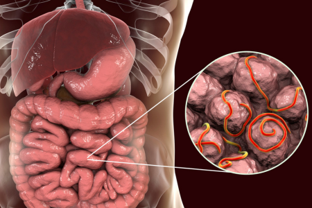 Parasites inside the body