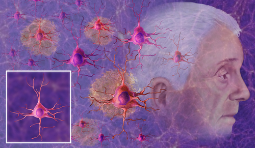 What's Actually Happening in Your Brain After 50